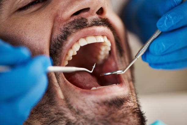 Best Broken or Cracked Tooth Emergency Dentist in Warner Robins, GA