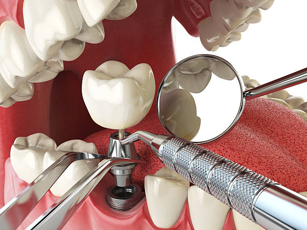 Best Pediatric Emergency Dentist in Warner Robins, GA