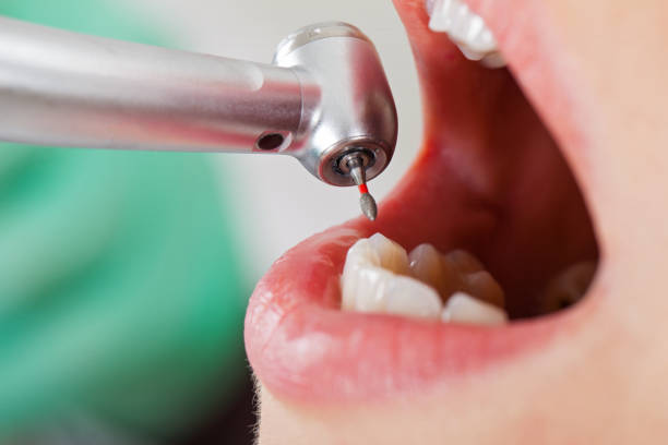 Best Emergency Cosmetic Dentistry in Warner Robins, GA